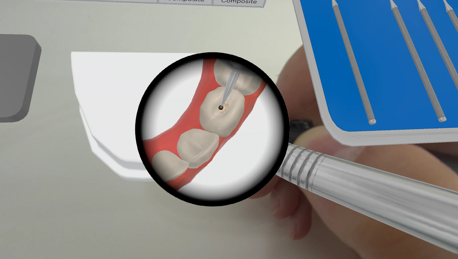 Magnified tooth showing fine fissure detail