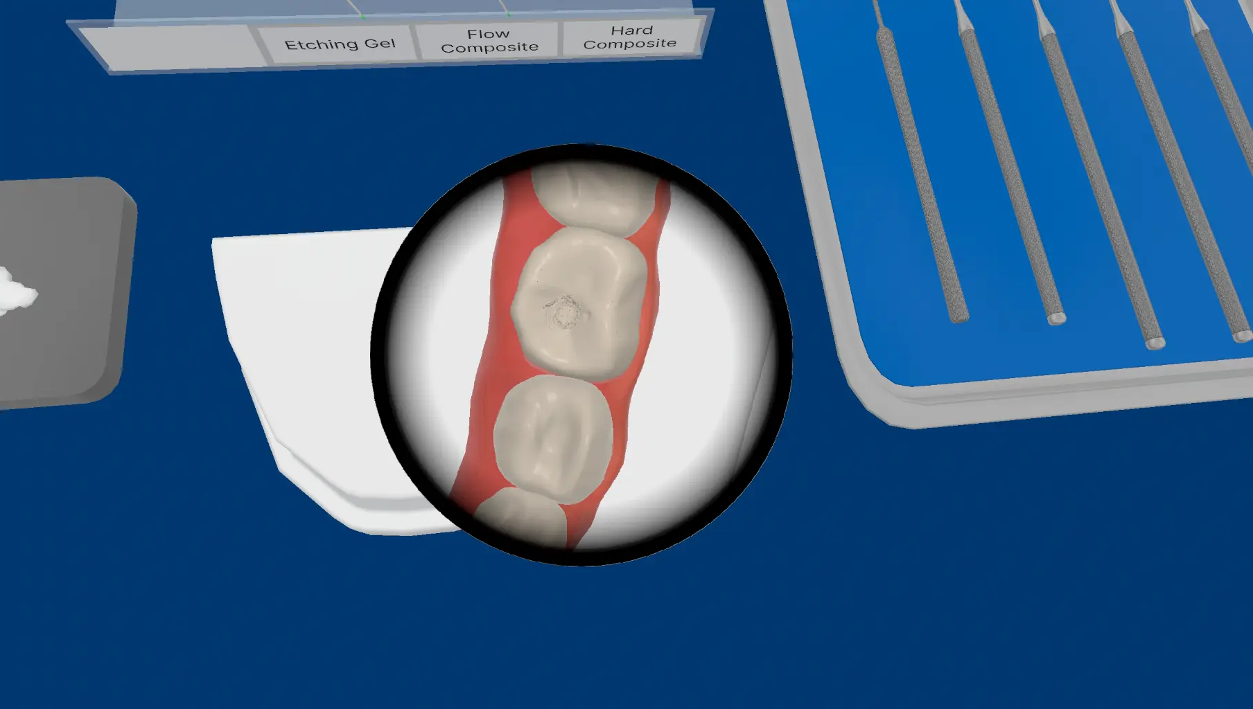 Cross-section showing pulp proximity