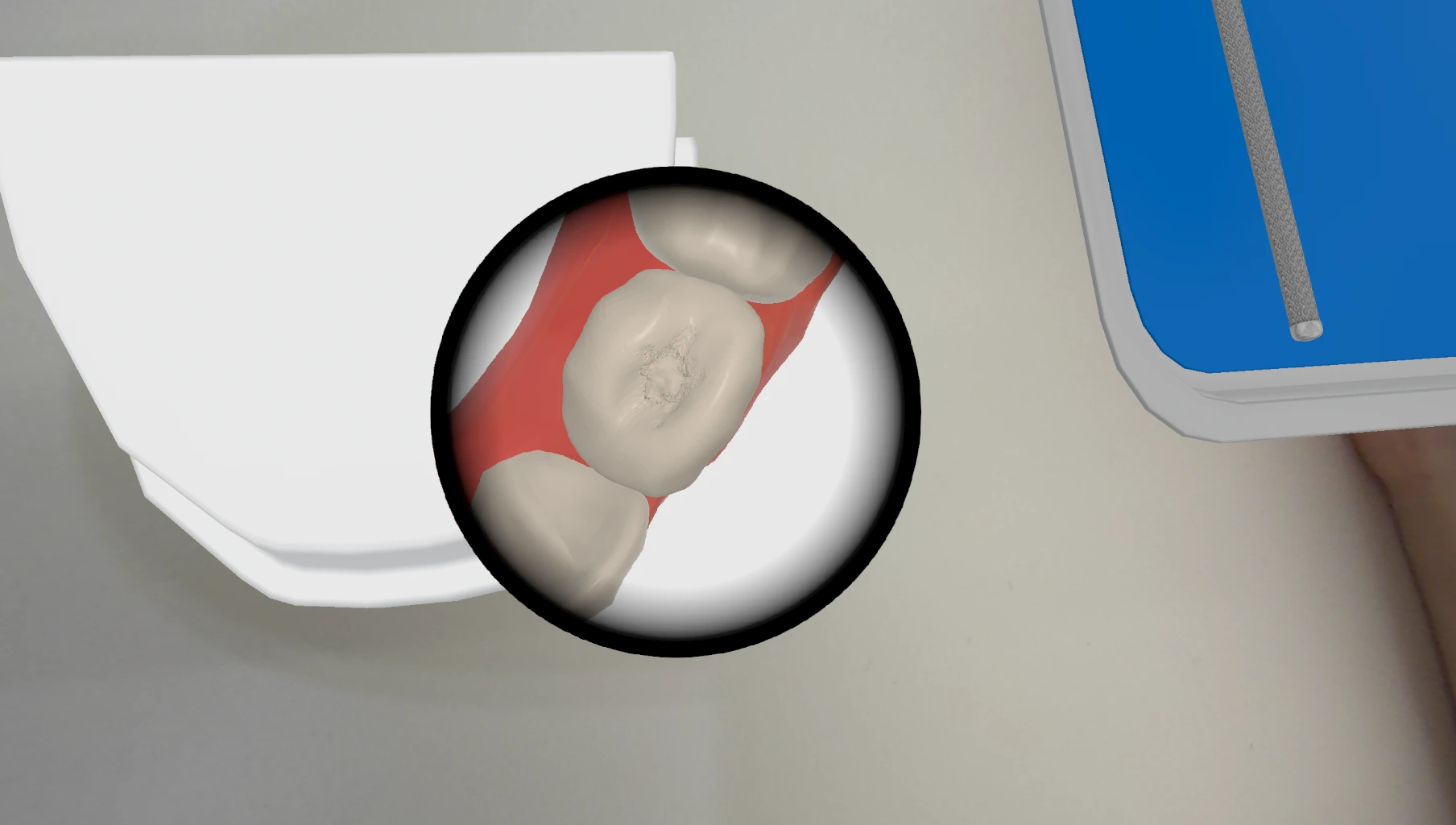 Cross-section showing pulp proximity