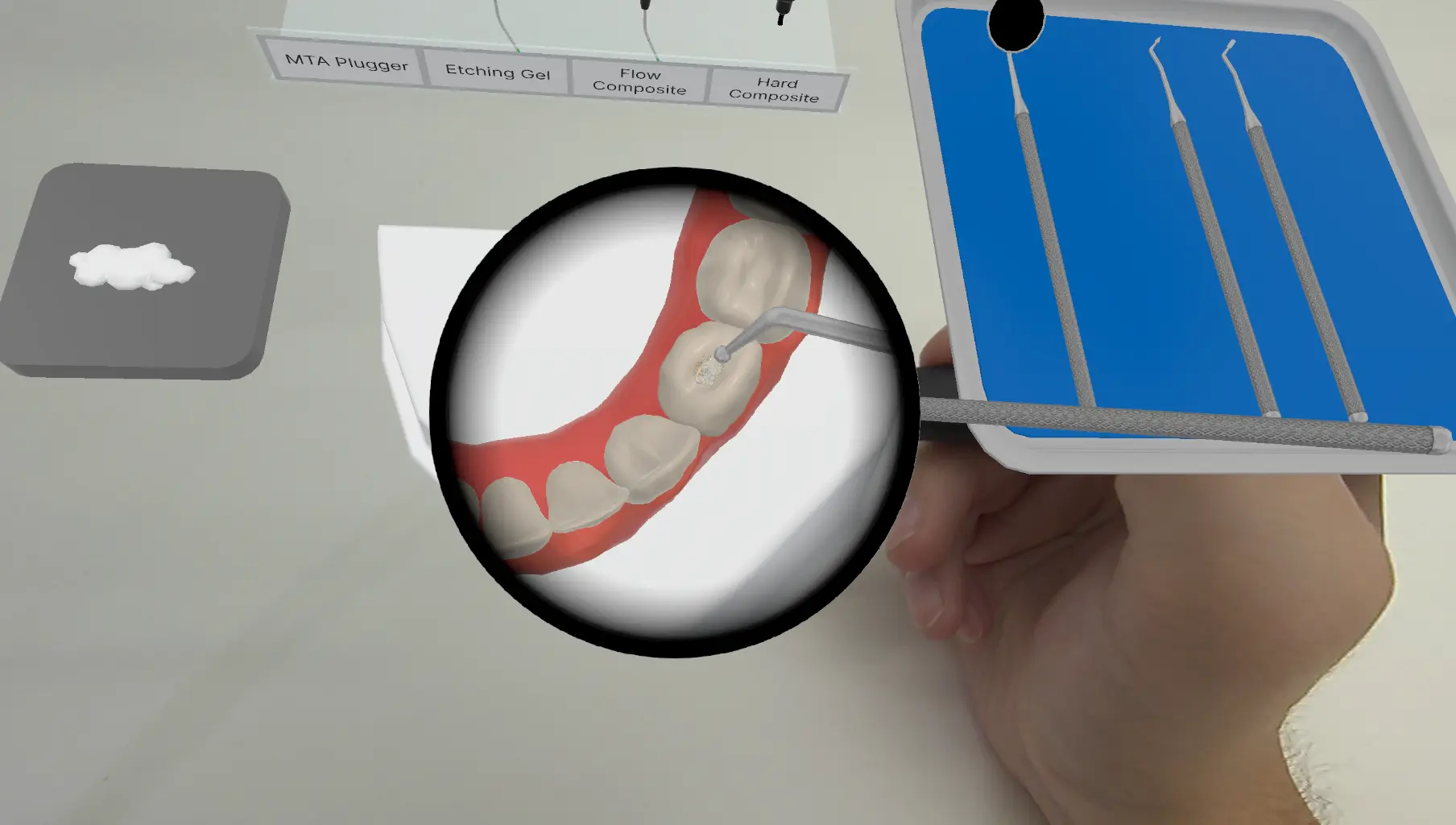 Cross-section showing early-stage caries