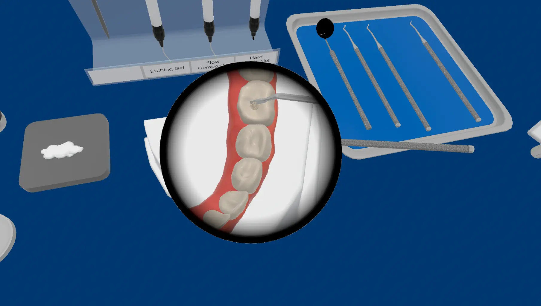 Cross-section showing early-stage caries